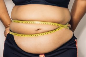 gangguan kesehatan obesitas